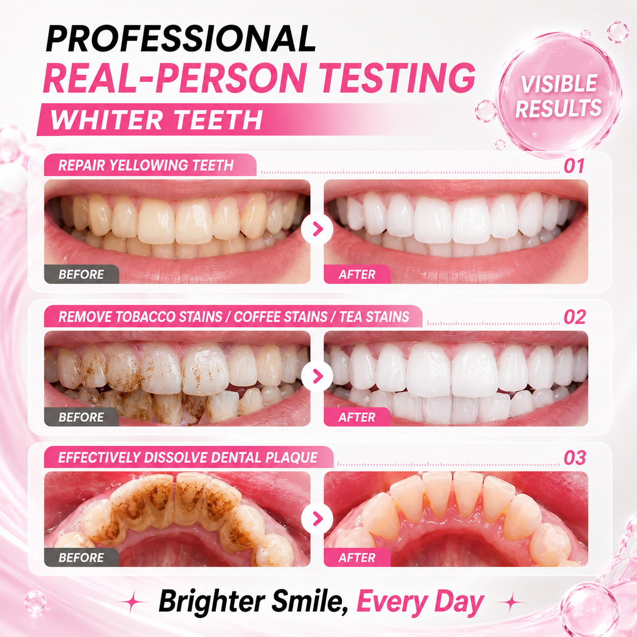 🏆Viral Tooth Care🔥 Tooth Shield Fluoride-Free Toothpaste Serum