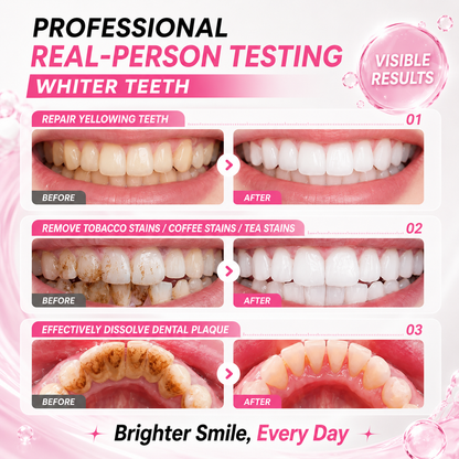🏆Viral Tooth Care🔥 Tooth Shield Fluoride-Free Toothpaste Serum