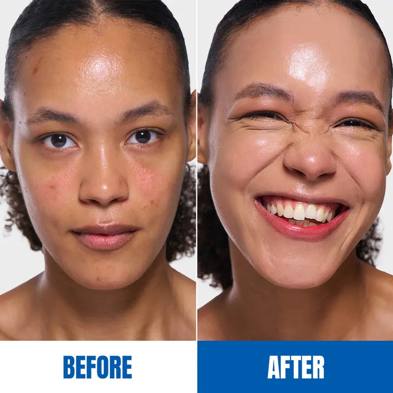 Before and after concealer coverage result